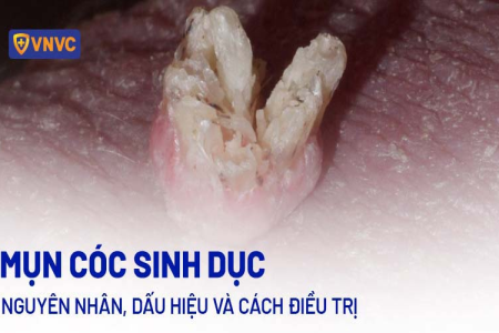 Trực tiếp kết quả xổ số ngày 9 tháng 8: Vĩnh Long, Bình Dương